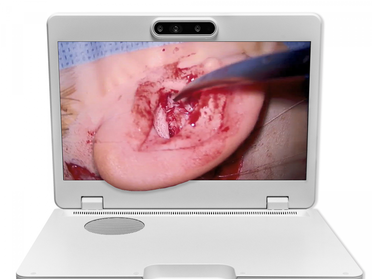 达擎之＂Heads-up 3D显微手术显示系统＂，整合4K裸眼3D显示及眼球追踪系统，具备快速追踪人眼移动位置功能，减轻医师长时间维持固定姿势的负担，让医师能有更宽广清晰的3D立体视野及更舒适的姿势来执行手术。